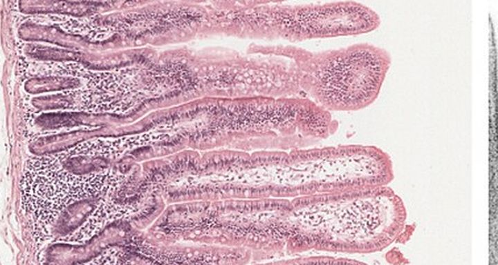 Vellosidades al microscopio: Intestino delgado, H&E