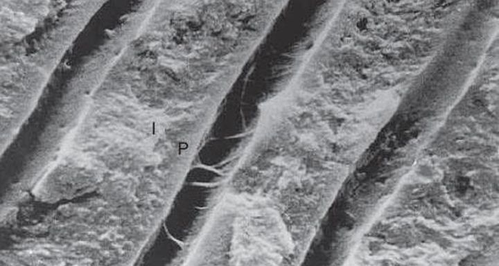 Túbulos dentinarios: Microscopio electrónico de barrido